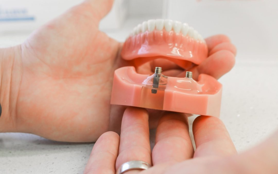 Dental Repairs Relines Apple Dentures