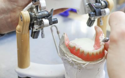 When to Reline Your Dentures vs Replacing Them